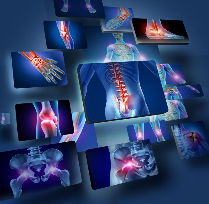 Pathologies neurofonctionnelles